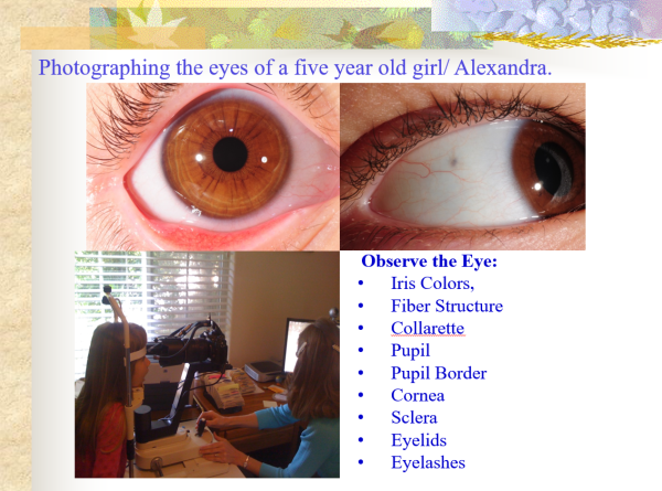 Photographing the eyse of a child in Iridology & Natural Health For Children ~ CD-ROM PPP