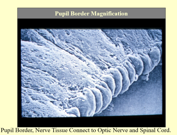 Pupil Border Magnification - Pupil Tonus ~ CD-ROM PPP
