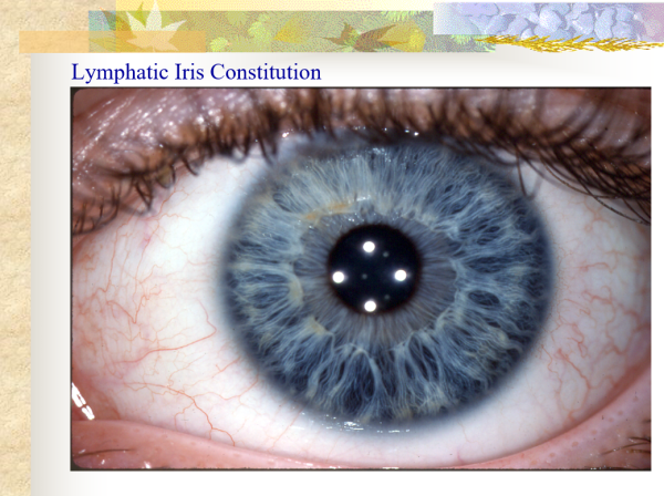 Lymphatic Iris Constitution - Iris Constitutions & Remedial Therapies ~ CD-ROM PPP